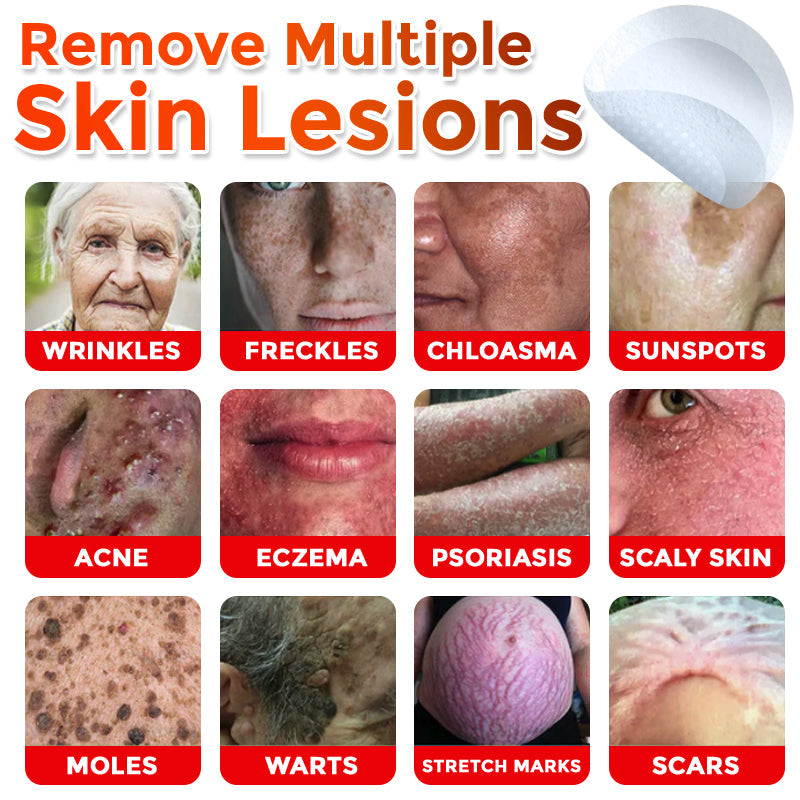 𝐓𝐋𝐎𝐏𝐀® 𝐌𝐢𝐜𝐫𝐨𝐧𝐞𝐞𝐝𝐥𝐞 𝐁𝐨𝐭𝐚𝐧𝐢𝐜 𝐒𝐤𝐢𝐧 𝐓𝐚𝐠 𝐑𝐞𝐦𝐨𝐯𝐚𝐥 𝐏𝐚𝐭𝐜𝐡  🇺🇸（Firming skin care丨wart removal丨no injection required丨effective in 5 days）🍁💖