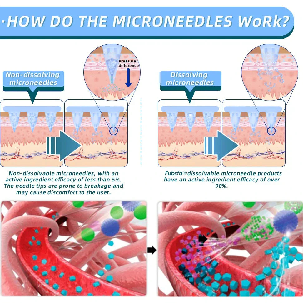 【Last Day Promotion 60% OFF💡】Lmipki® NIDDK-Tirzepatide Nano Microneedle Patch 🇺🇸👩🏻‍⚕️（Zero Pain, 24/7 Release | Lose 20lbs FAST | 90% Sugar Drop | ）