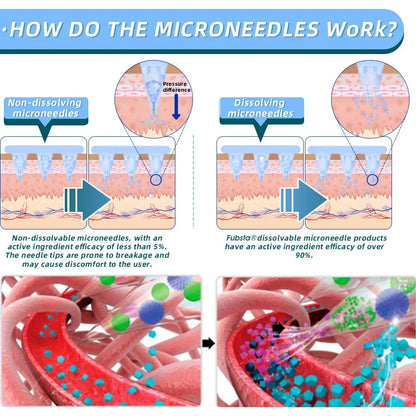 【Last Day Promotion 60% OFF💡】Lmipki® NIDDK-Tirzepatide Nano Microneedle Patch 🇺🇸👩🏻‍⚕️（Zero Pain, 24/7 Release | Lose 20lbs FAST | 90% Sugar Drop | ）